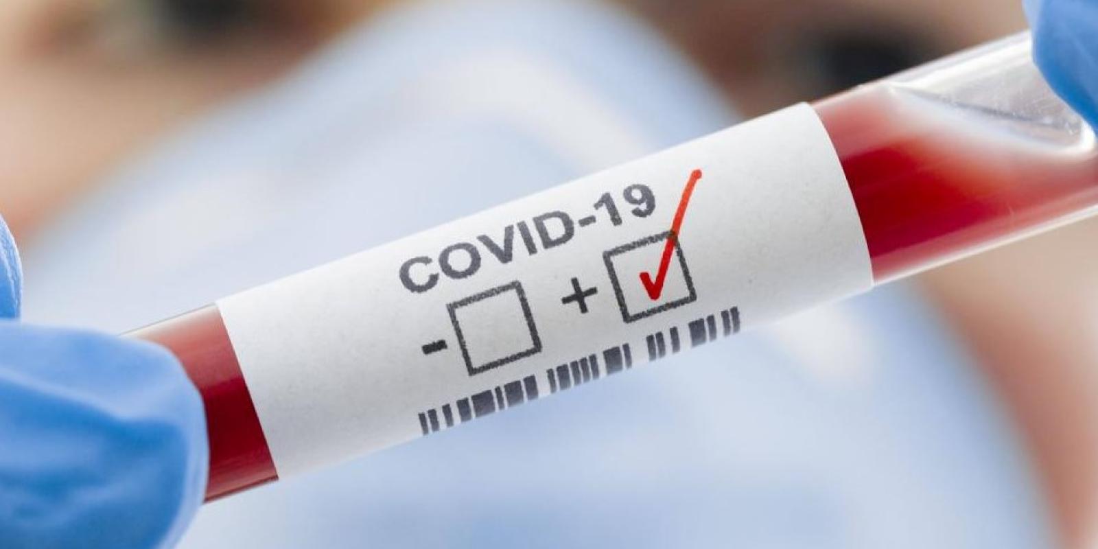 На Київщині зросла кількість хворих на COVID-19