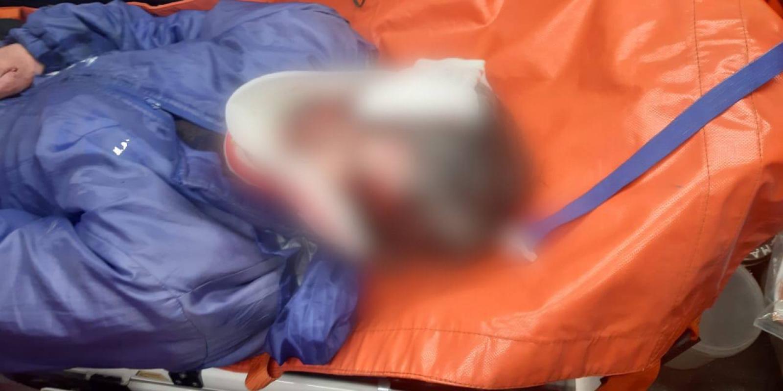 ДТП на Житомирській трасі: легковик збив пішохода ДТП на Житомирській трасі: легковик збив пішохода