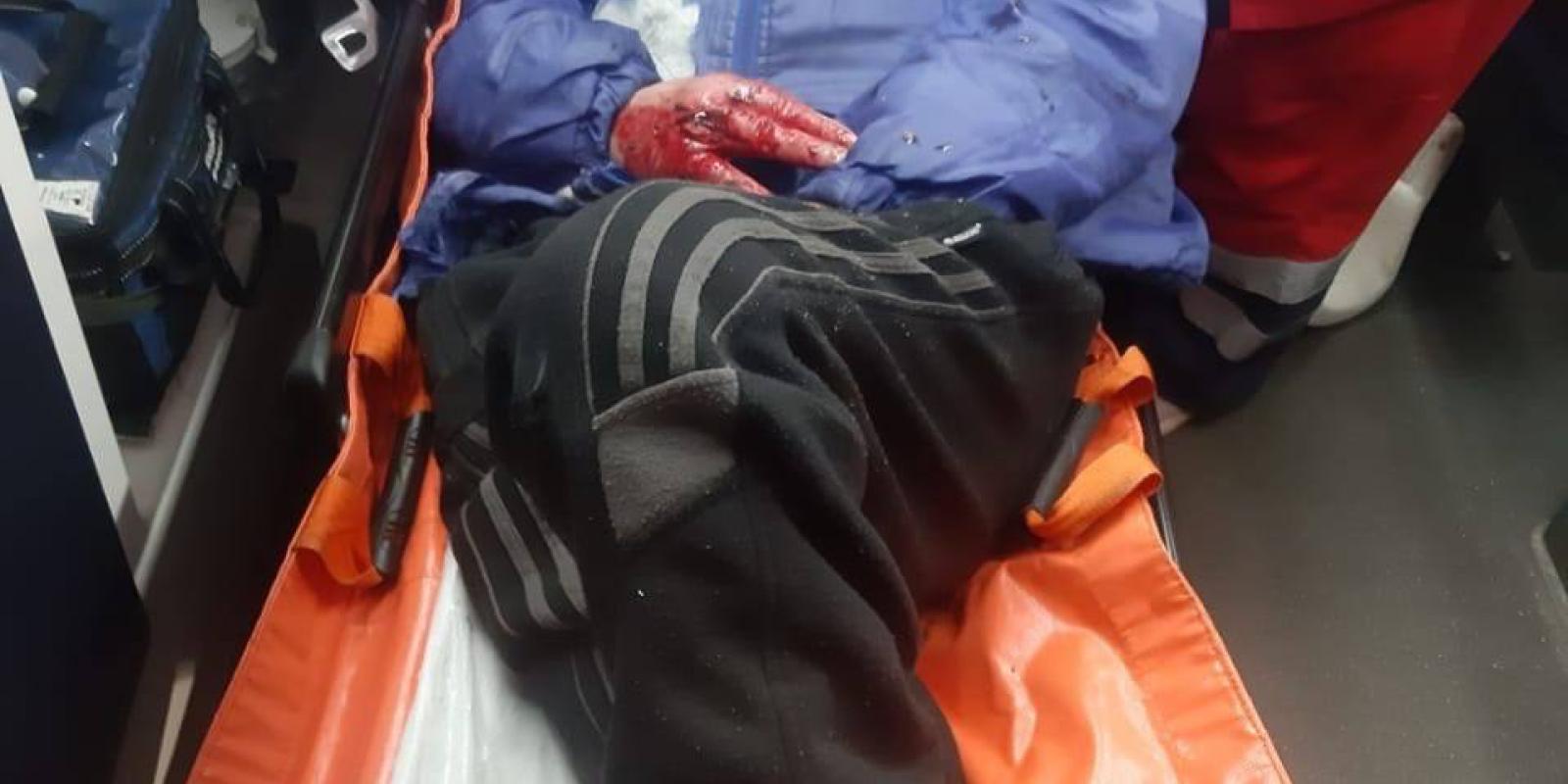 За добу на Київщині трапилося 13 ДТП: є постраждалі За добу на Київщині трапилося 13 ДТП: є постраждалі